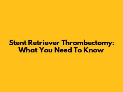 Stent Retriever Thrombectomy: What You Need To Know